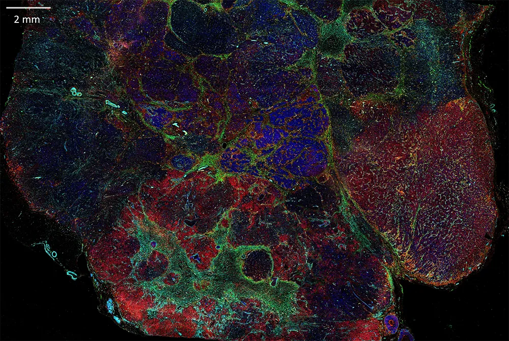 IMC Stained Tissue Sample