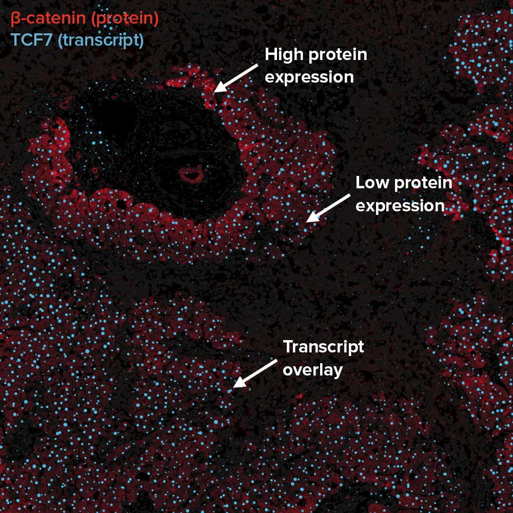 low and high protein expression